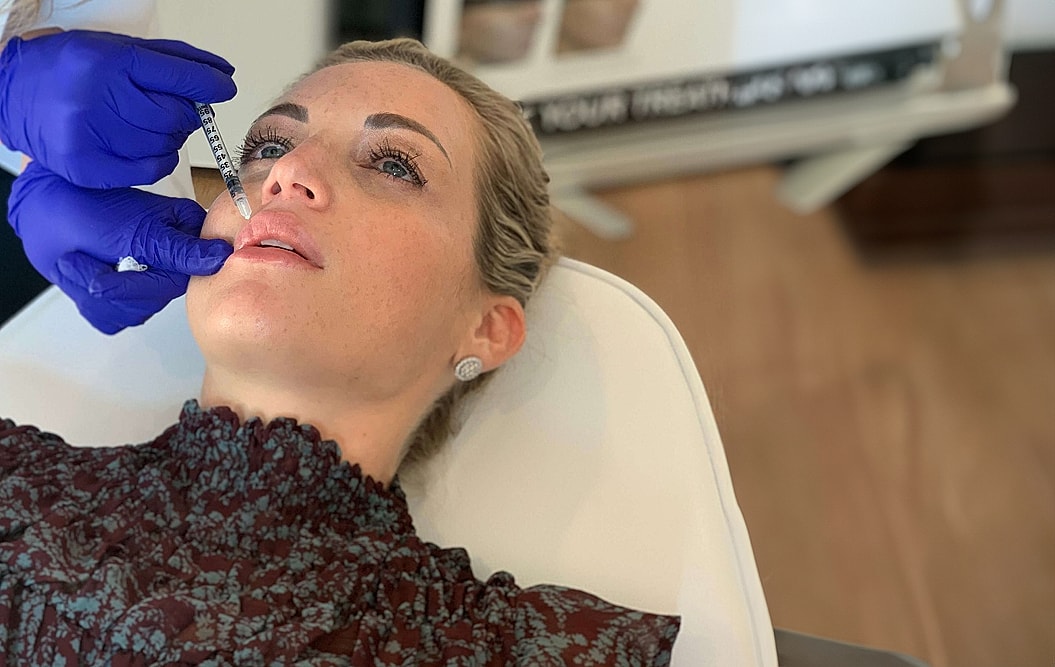 Woman receiving lip filler treatment in clinic.